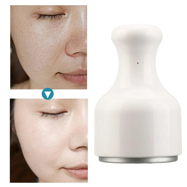 Masajeador Facial Frío para Piel – Ice Roller Calmante y Reafirmante